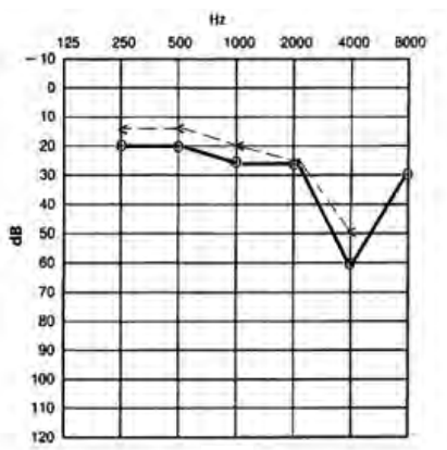 Ilustracja do odpowiedzi A