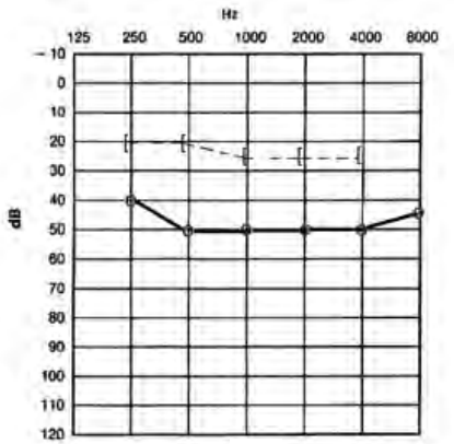 Ilustracja do odpowiedzi C