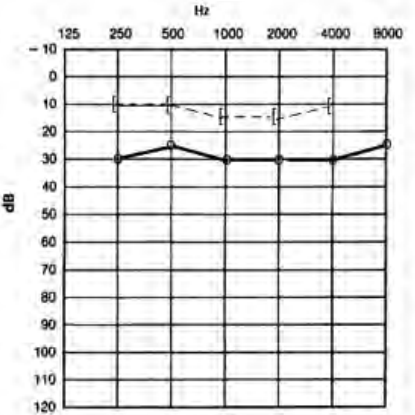 Ilustracja do odpowiedzi B