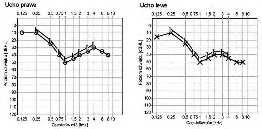 Ilustracja do pytania 2