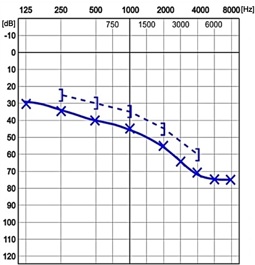 Ilustracja do pytania 12