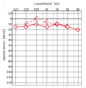 Ilustracja do odpowiedzi B