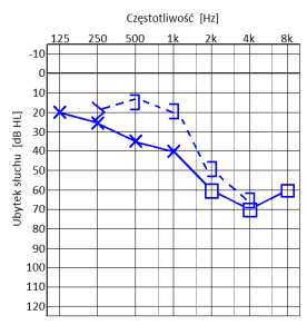 Ilustracja do odpowiedzi A