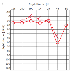 Ilustracja do odpowiedzi D