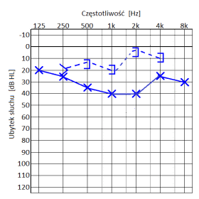 Ilustracja do odpowiedzi C