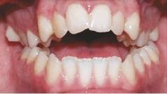 Ilustracja do pytania