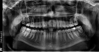 Ilustracja do pytania