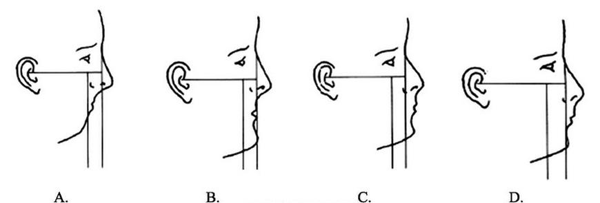 Ilustracja do pytania