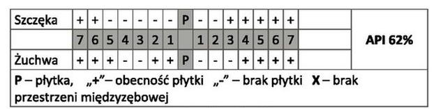 Ilustracja do pytania