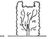 Ilustracja do odpowiedzi C