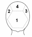 Wariant D