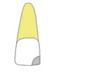 Wariant A