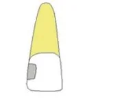 Wariant B