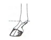 Ilustracja do odpowiedzi A