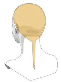 Wariant C
