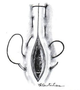 Ilustracja do pytania 35