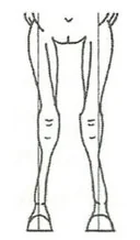 Wariant B