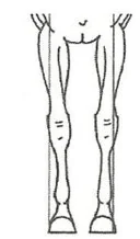 Wariant C