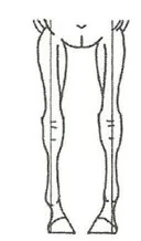 Wariant A